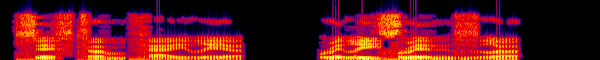 Audio spectrogram